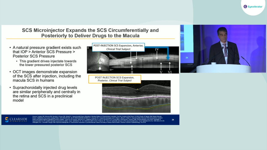 AAO22-Retina-Clearside